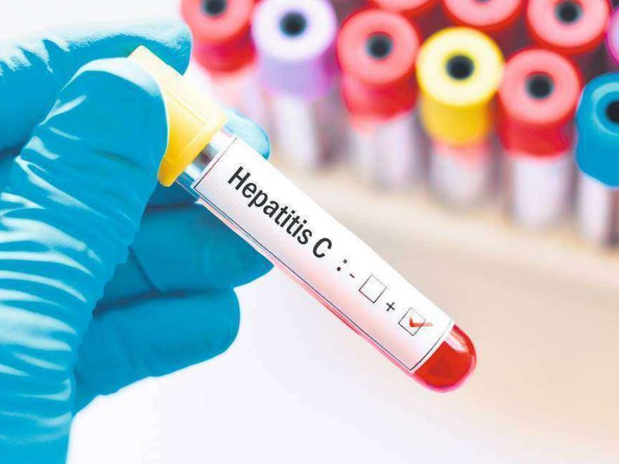 hepatita_84e55.jpg