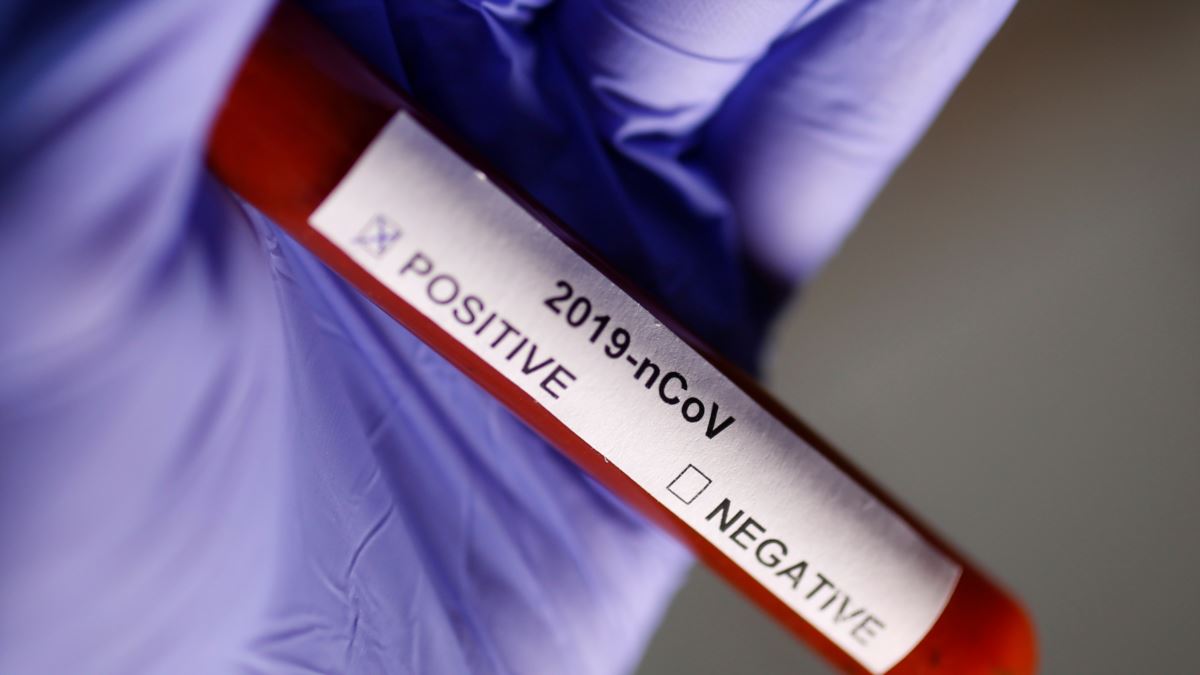 coronavirus_b62c8.jpg